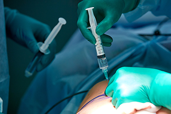 regional anesthesia